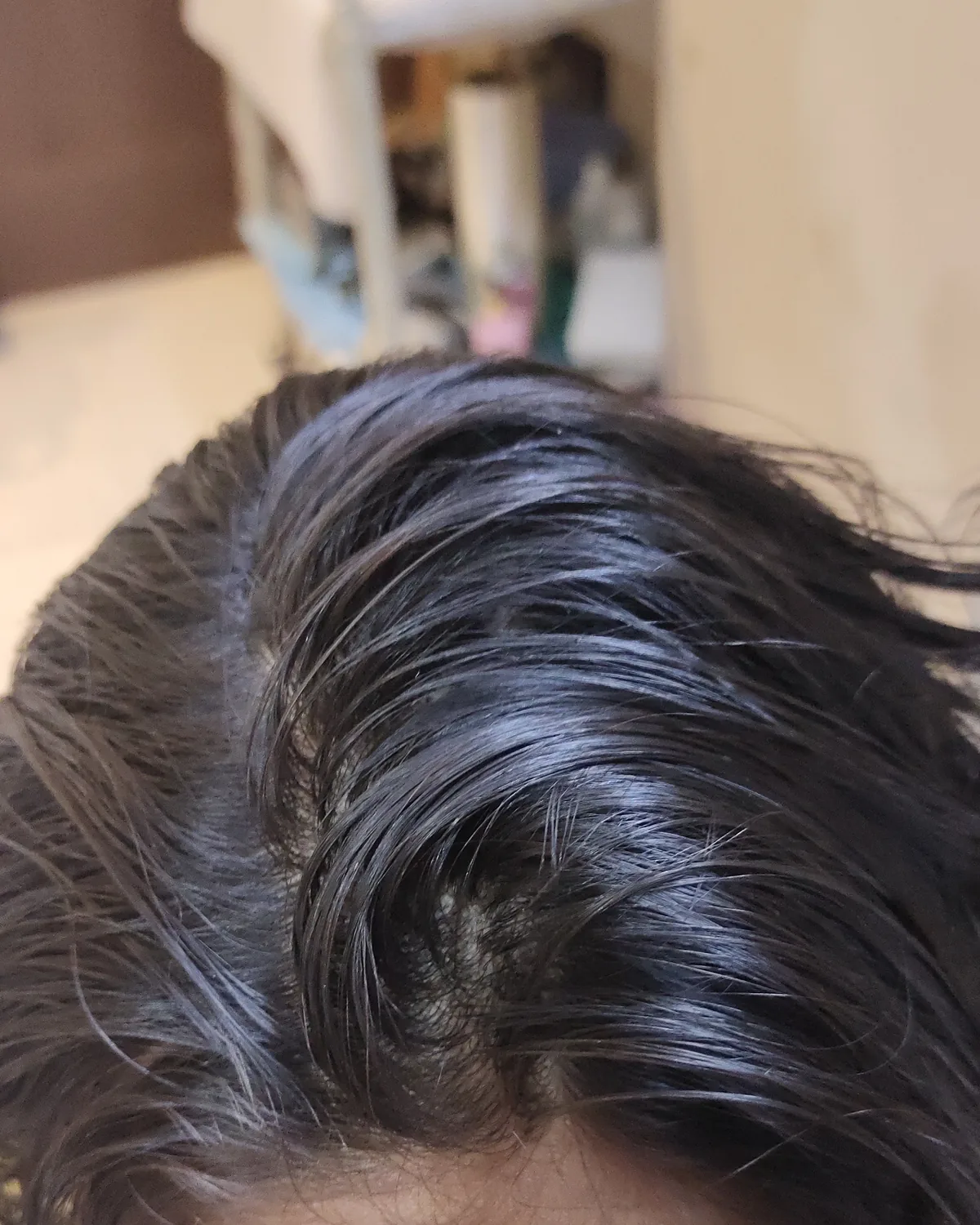 The same scalp with thick dark hair covering the crown and a clean parting. The frame is cropped above the brow.